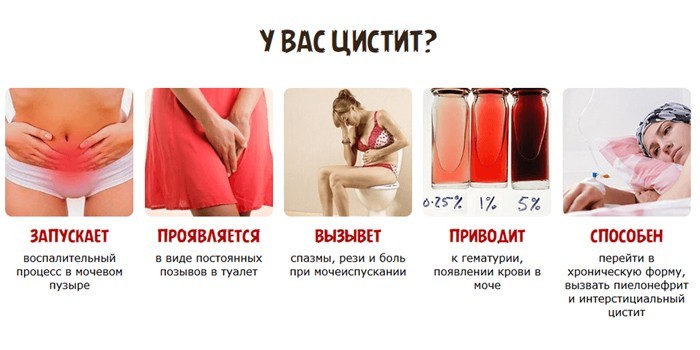 Ректальні свічки при циститі