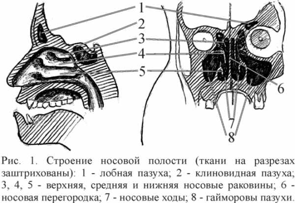 Що буде якщо в гайморову пазуху потрапить пломбувальний матеріал
