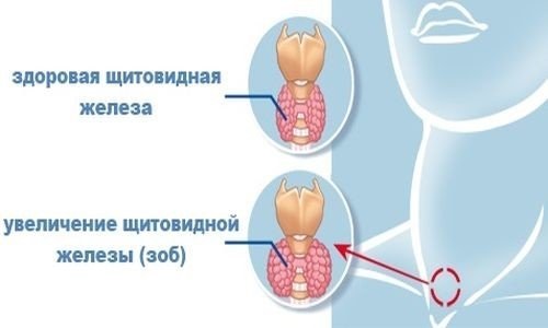 Що може викликати ком у горлі та біль у грудині