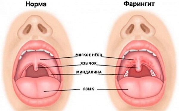 Що може викликати ком у горлі та біль у грудині