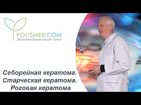 Старечі бородавки вікові кератоми лікування народними засобами