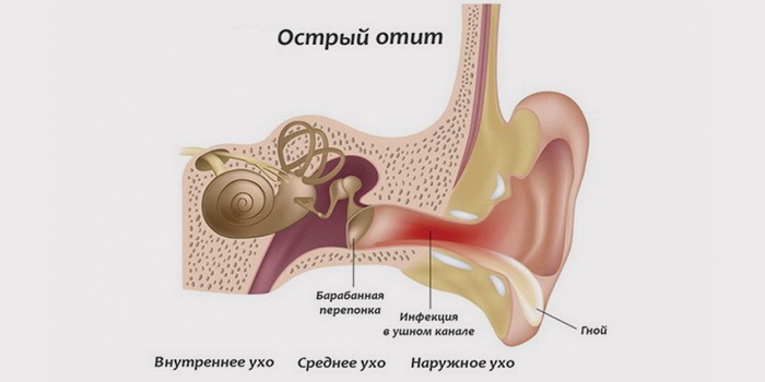 Страшна операція на вусі при отиті