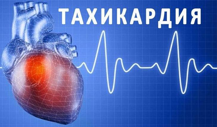 Тахікардія – лікування народними засобами