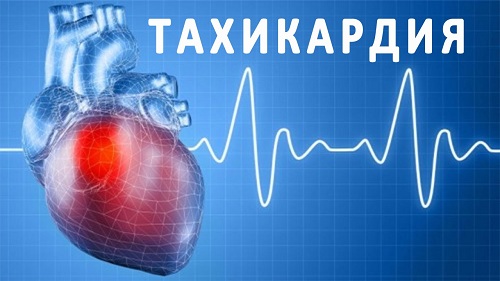 Тахікардія – лікування народними засобами