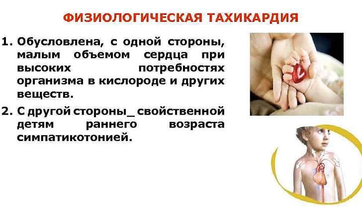 Тахікардія – лікування народними засобами
