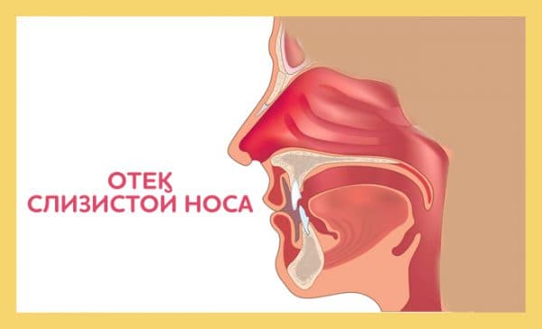 Техніка точкового масажу при нежиті