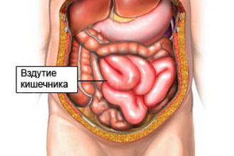 Трави від здуття живота і газоутворення народні засоби від метеоризму