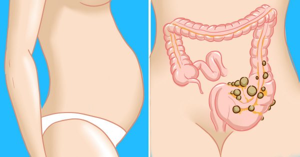 Трави від здуття живота і газоутворення народні засоби від метеоризму