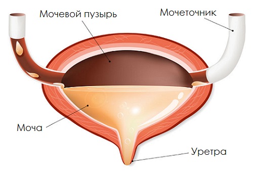 Уросептики в терапії циститу у жінок