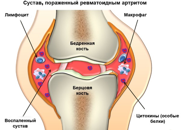 Верба біла лікувальні властивості застосування і рецепти