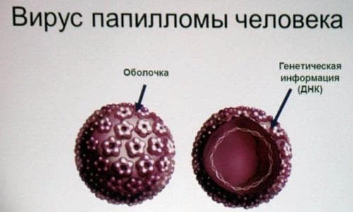 Видалення папіломи на столітті очі в домашніх умовах народними засобами