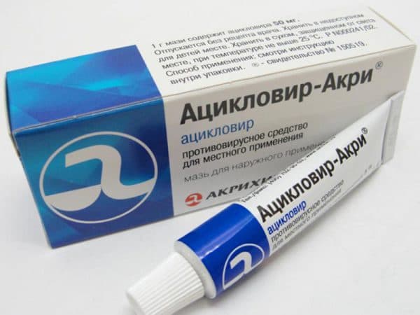 Видалення папіломи на столітті очі в домашніх умовах народними засобами