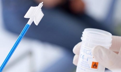Які аналізи здати при циститі у жінок Нирки