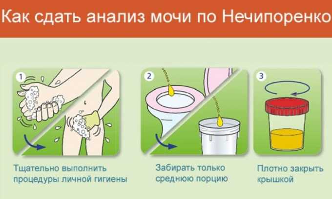 Які аналізи здати при циститі у жінок Нирки