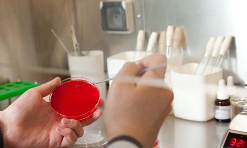 Які аналізи здати при циститі у жінок Нирки