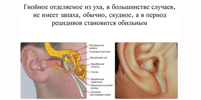 Які антибіотики пити при отиті