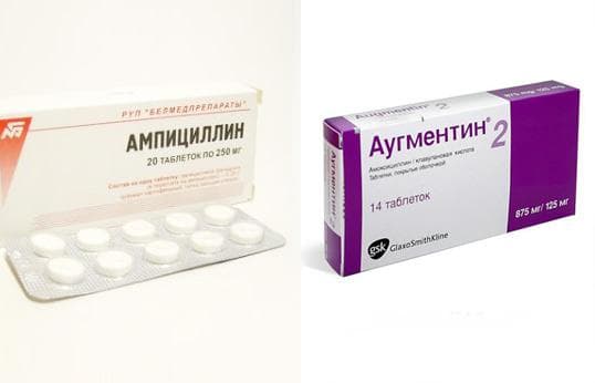Які антибіотики призначають при синуситі