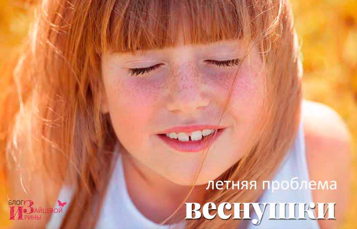 Як позбавитися від веснянок в домашніх умовах