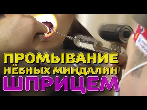 Як промити мигдалини