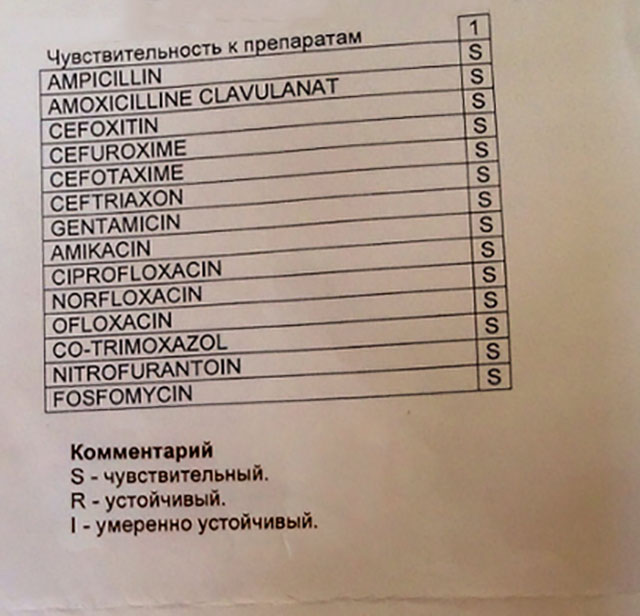 Як проводиться бак посів сечі