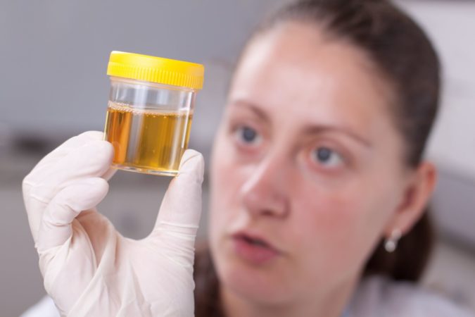 Як проводиться бак посів сечі