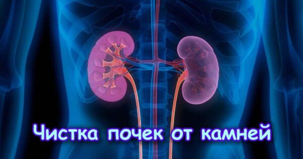 Як розчинити камені в нирках народними засобами Нирки