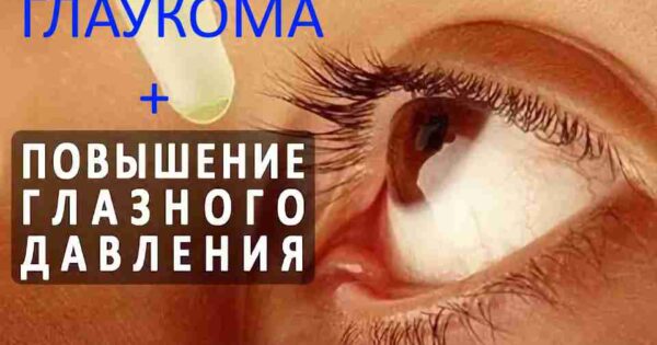 Як вилікувати глаукому народними засобами