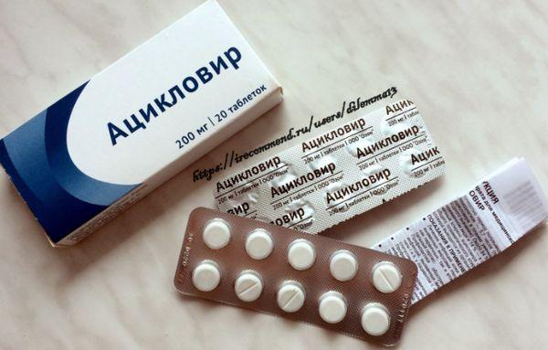 Як застосовувати Ацикловір при ангіні Як застосовувати Ацикловір при ангіні