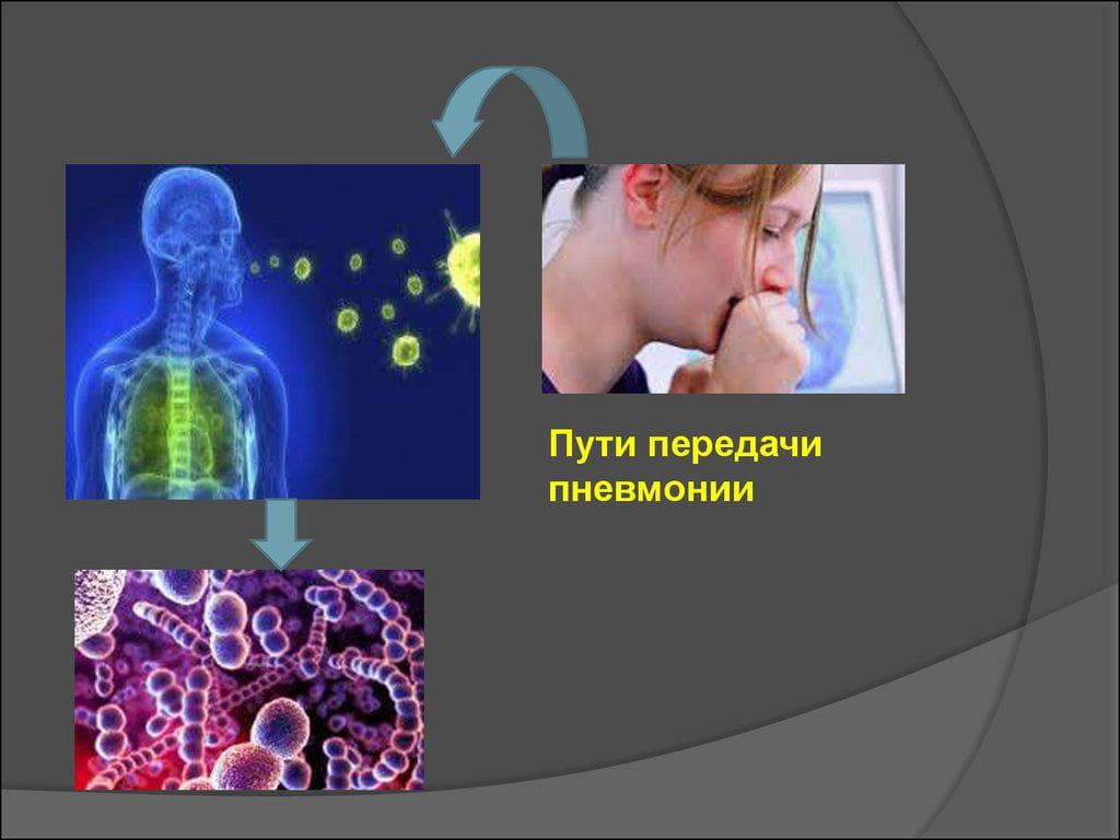 Яким чином передається пневмонія