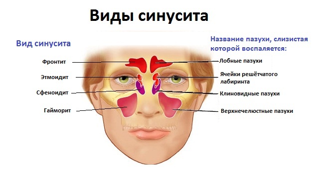 Зелені соплі у дитини звідки і чому
