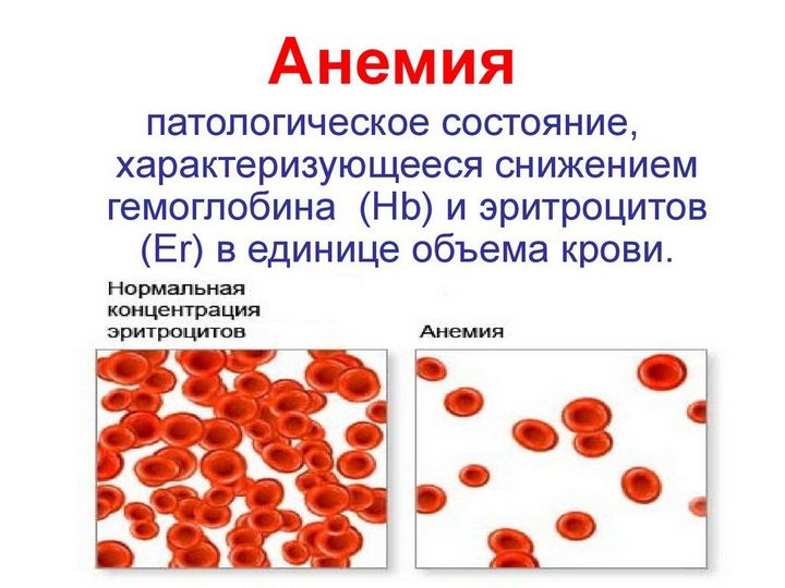 Зелена гречка — користь та шкоду, як приготувати, чим відрізняється від звичайної