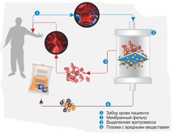 Жовтяниця у дорослих і дітей. Народні методи лікування