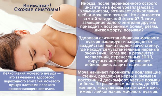 Чим і як лікувати хронічну форму циститу у жінок