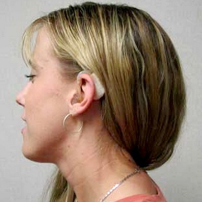 Слуховий апарат – який краще вибрати, як вибрати, як працює слуховий апарат?