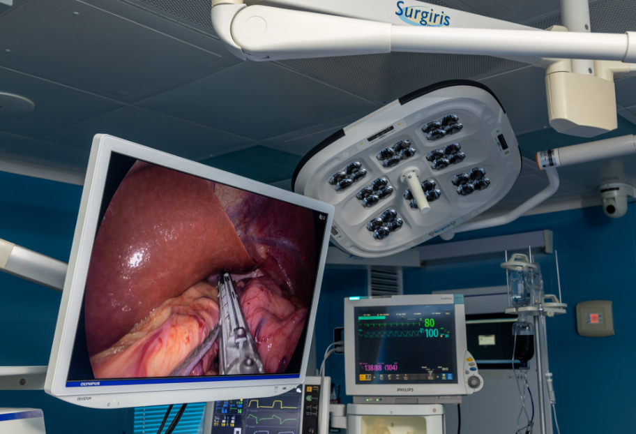 Резекція шлунка: сучасний погляд баріатричного хірурга